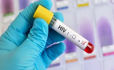 uttarakhand  स्मैक की लत में किशोरी ने 20 युवकों को बना दिया hiv का रोगी